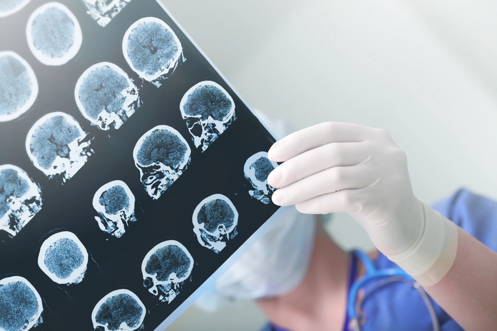 brain injury lawyer in Pasadena, TX